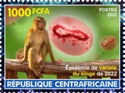 Monkeypox outbreak of 2022