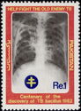 Centenary Of Discovery Of TB Bacillus