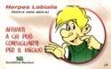Herpes Labialis