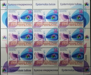 Children's Disease Awareness : Epidermolysis Bullosa