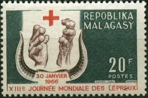 Leper’s Crippled Hands