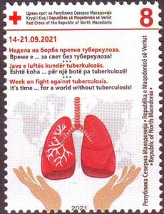 Tuberculosis Awareness