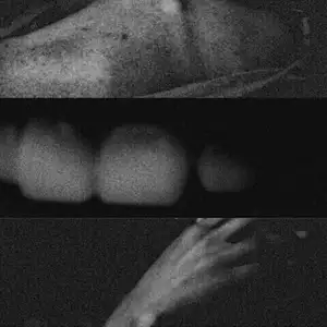 Suture [5]: Misfortune