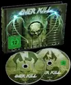 Overkill: The Electric Age
